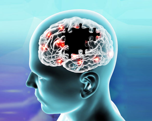 alzheimers-disease-treatment